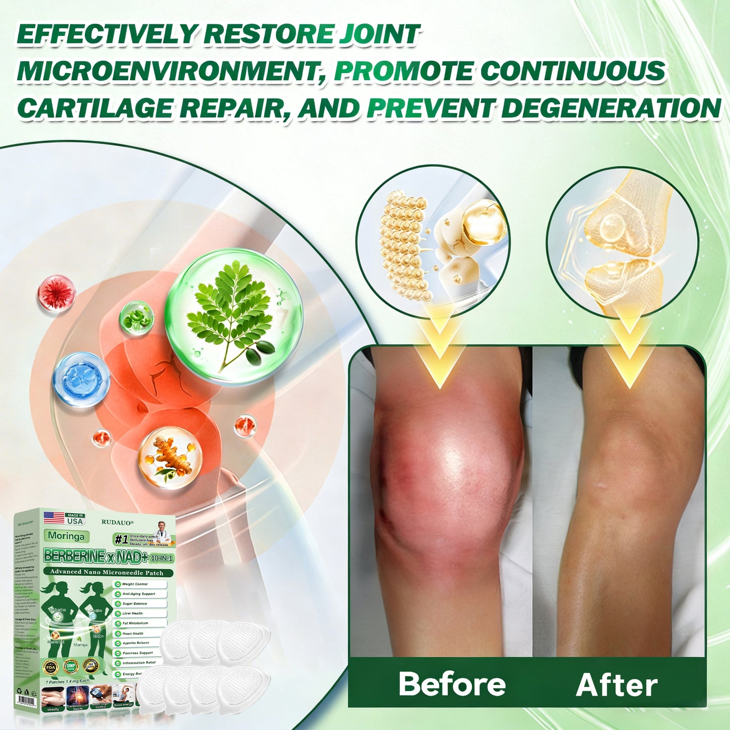 𝐎𝐟𝐟𝐢𝐜𝐢𝐚𝐥 𝐔𝐒 𝐒𝐭𝐨𝐫𝐞 |🎁𝐑𝐔𝐃𝑨𝑼𝑶® Moringa · Berberine × NAD+ 𝟏𝟎-𝐢𝐧-𝟏 𝐀𝐝𝐯𝐚𝐧𝐜𝐞𝐝 𝐍𝐚𝐧𝐨 𝐌𝐢𝐜𝐫𝐨𝐧𝐞𝐞𝐝𝐥𝐞 𝐏𝐚𝐭𝐜𝐡 — 𝐎𝐧𝐜𝐞 𝐃𝐚𝐢𝐥𝐲, 𝐕𝐢𝐬𝐢𝐛𝐥𝐞 𝐑𝐞𝐬𝐮𝐥𝐭𝐬 𝐢𝐧 𝟕 𝐃𝐚𝐲𝐬