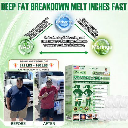 𝐎𝐟𝐟𝐢𝐜𝐢𝐚𝐥 𝐔𝐒 𝐒𝐭𝐨𝐫𝐞 | 🇺🇸🗽 𝐑𝐔𝐃𝑨𝑼𝑶® Moringa · Berberine × NAD+ 𝟏𝟎-𝐢𝐧-𝟏 𝐀𝐝𝐯𝐚𝐧𝐜𝐞𝐝 𝐍𝐚𝐧𝐨 𝐌𝐢𝐜𝐫𝐨𝐧𝐞𝐞𝐝𝐥𝐞 𝐏𝐚𝐭𝐜𝐡 — 𝐎𝐧𝐜𝐞 𝐃𝐚𝐢𝐥𝐲, 𝐕𝐢𝐬𝐢𝐛𝐥𝐞 𝐑𝐞𝐬𝐮𝐥𝐭𝐬 𝐢𝐧 𝟕 𝐃𝐚𝐲𝐬