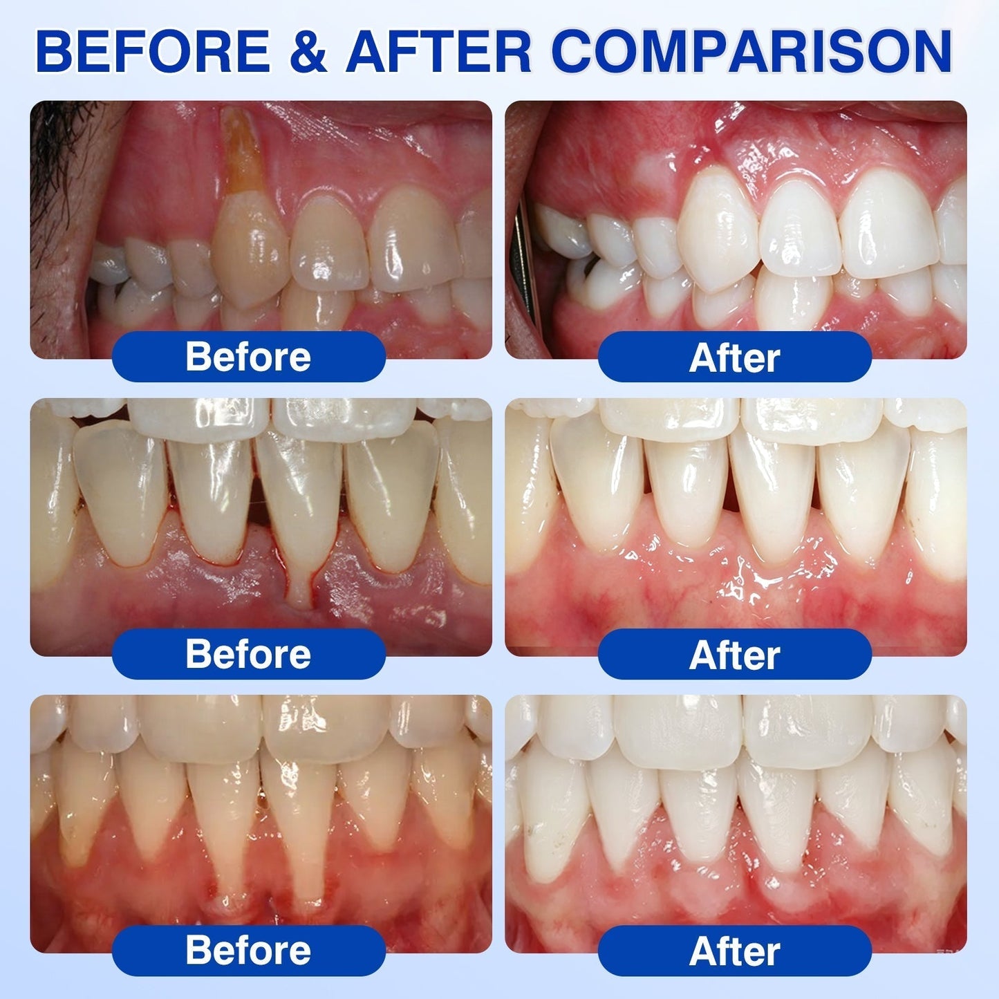 𝓡𝐔𝓓𝐀𝐔𝐎®🦷 GumVital Advanced Gum Care Gel + 🎁 FREE Gum Care Kit