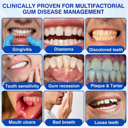 𝓡𝐔𝓓𝐀𝐔𝐎®🦷 GumVital Advanced Gum Care Gel + 🎁 FREE Gum Care Kit