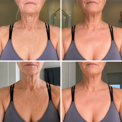 𝓡𝐔𝓓𝐀𝐔𝐎® ❀𝐏D𝐑N 𝐌u𝐥t𝐢-P𝐞p𝐭i𝐝e 𝐅i𝐫m𝐢n𝐠 𝐁o𝐝y 𝐓r𝐞a𝐭m𝐞n𝐭 - 𝐀n𝐭i-𝐀g𝐢n𝐠, 𝐇y𝐝r𝐚t𝐢n𝐠, 𝐒k𝐢n 𝐅i𝐫m𝐢n𝐠 & 𝐋i𝐟t𝐢n𝐠, 𝐒k𝐢n 𝐑e𝐩a𝐢r, 𝐄v𝐞n 𝐓o𝐧e, 𝐀c𝐧e 𝐚n𝐝 𝐃a𝐫k 𝐒p𝐨t 𝐓r𝐞a𝐭m𝐞n𝐭, 𝐖a𝐫t 𝐚n𝐝 𝐌o𝐥e 𝐑e𝐦o𝐯a𝐥, 𝐚n𝐝 𝐏s𝐨r𝐢a𝐬i𝐬 𝐑e𝐥i𝐞f