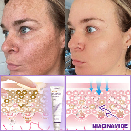 𝓡𝐎𝐔𝐀𝐔𝓓® 🔔 𝐏D𝐑N 𝐌u𝐥t𝐢-P𝐞p𝐭i𝐝e 𝐅i𝐫m𝐢n𝐠 𝐁o𝐝y 𝐓r𝐞a𝐭m𝐞n𝐭 - 𝐀n𝐭i-𝐀g𝐢n𝐠, 𝐇y𝐝r𝐚t𝐢n𝐠, 𝐒k𝐢n 𝐅i𝐫m𝐢n𝐠 & 𝐋i𝐟t𝐢n𝐠, 𝐒k𝐢n 𝐑e𝐩a𝐢r, 𝐄v𝐞n 𝐓o𝐧e, 𝐀c𝐧e 𝐚n𝐝 𝐃a𝐫k 𝐒p𝐨t 𝐓r𝐞a𝐭m𝐞n𝐭, 𝐖a𝐫t 𝐚n𝐝 𝐌o𝐥e 𝐑e𝐦o𝐯a𝐥, 𝐚n𝐝 𝐏s𝐨r𝐢a𝐬i𝐬 𝐑e𝐥i𝐞f