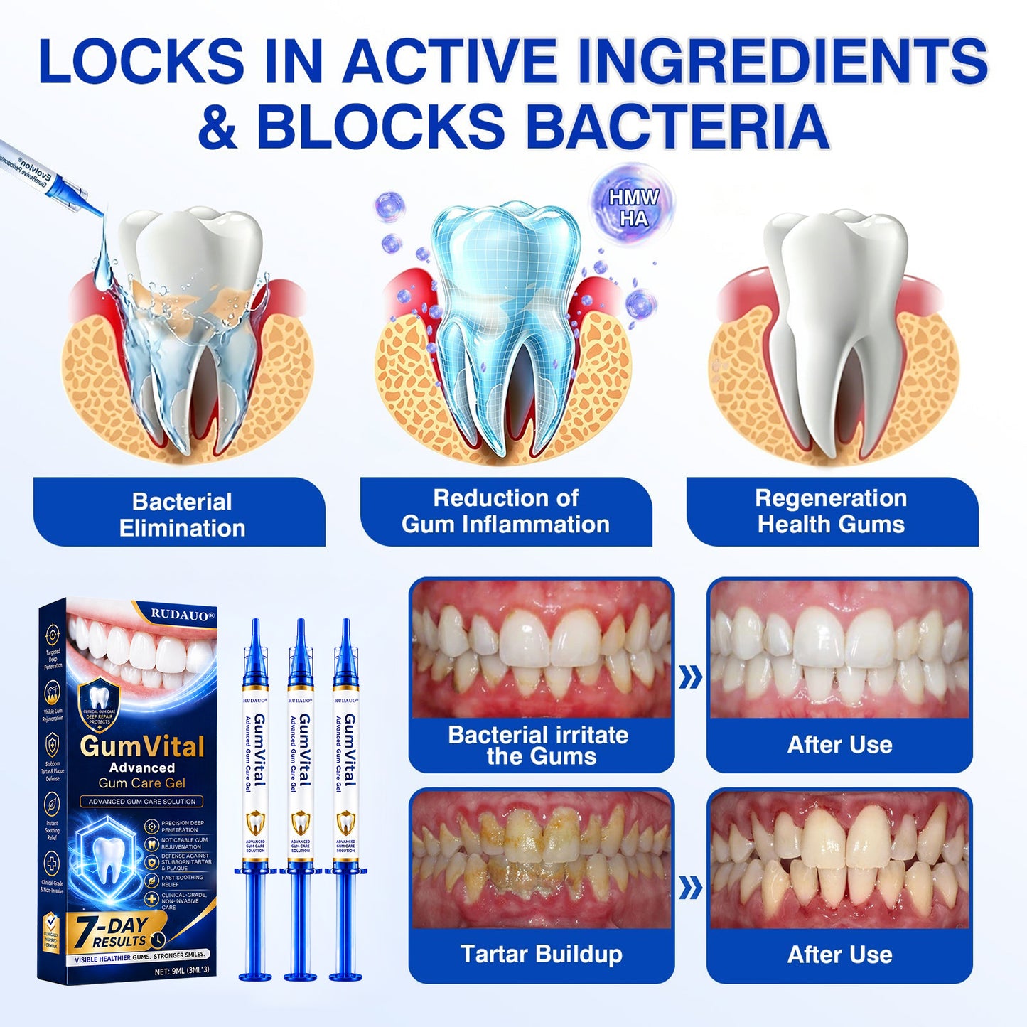 𝓡𝐔𝓓𝐀𝐔𝐎®🦷 GumVital Advanced Gum Care Gel + 🎁 FREE Gum Care Kit