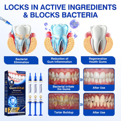 𝓡𝐔𝓓𝐀𝐔𝐎®🦷 GumVital Advanced Gum Care Gel + 🎁 FREE Gum Care Kit