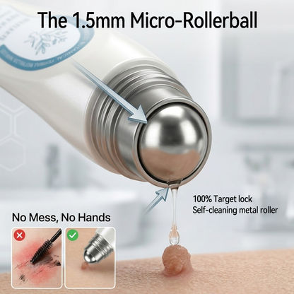 𝐉𝐎𝑼𝐒®🔥 Official Store7-𝐷𝑎𝑦 𝗧𝐚𝐠 & 𝗦𝗽𝐨𝐭 𝐄𝐫𝒂𝒔𝒆𝒓(Zero Pain, Zero 𝐒𝐜𝐚𝒓𝒔 Rollerball)
